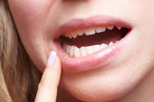 Woman with pain in her gums holding finger to mouth