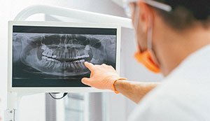 Dentist checking x-ray